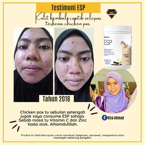 We did not find results for: Hilangkan Parut Di Muka Dengan Set Kecantikan Shaklee ...