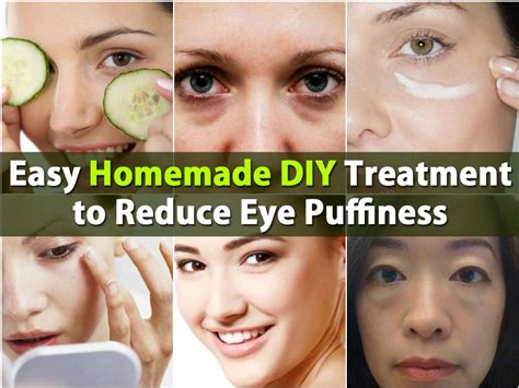 Easy Homemade Diy Treatment To Reduce Eye Puffiness Diy And Crafts