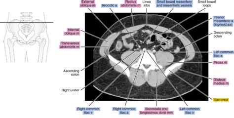 CT Of The Male Pelvis Radiology Key