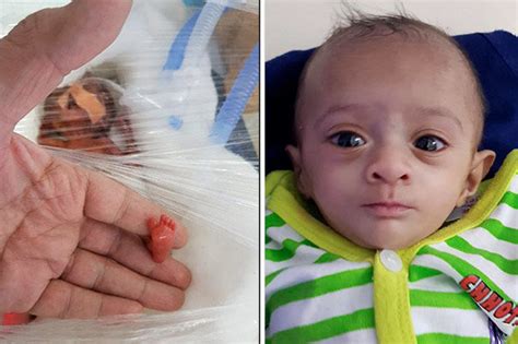 Worlds Smallest Baby Asia Manushi Survives Despite Weighing Same As
