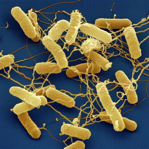 Salmonella Typhimurium Bacteria Photograph By Juergen Berger Science