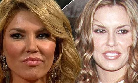 Brandi Glanville Before And After