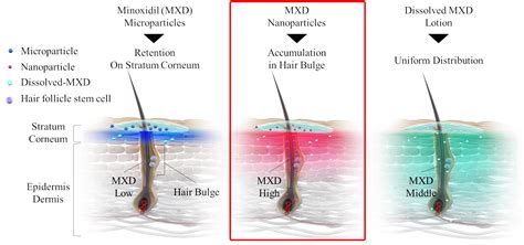 Pharmaceutics Free Full Text Minoxidil Nanoparticles Targeting Hair