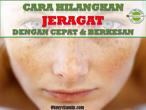 Hmm, mungkin 3 hal ini penyebabnya. 7 PUNCA JERAGAT DAN CARA HILANGKAN JERAGAT DENGAN CEPAT ...