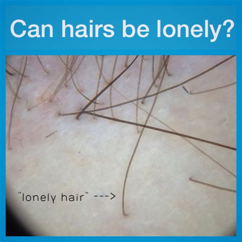 Lonely Hairs What Are They What Do They Signify — Donovan Hair Clinic