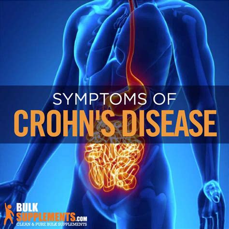 Crohns Disease Symptoms Causes And Treatment