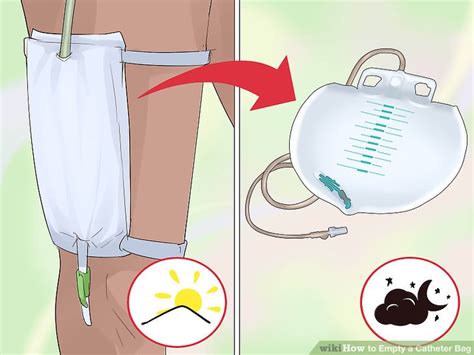 How To Empty A Catheter Bag 14 Steps With Pictures Wikihow