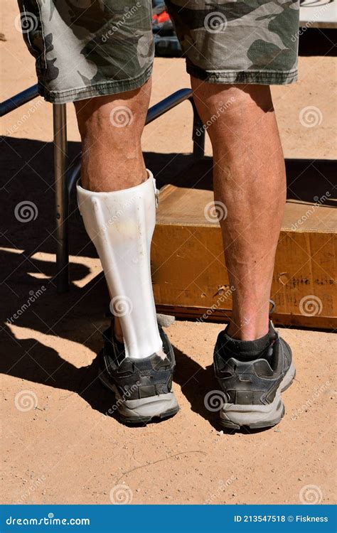 Supportive Plastic Leg Brace Worn By A Man Stock Photo Image Of