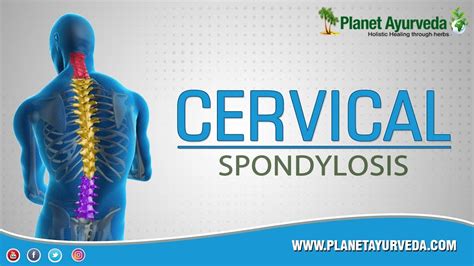 Cervical Spondylosis Treatment In Ayurveda सर्वाइकल स्पोन्डयलोसिस के