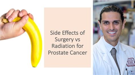 Side Effects Of Surgery Vs Radiation For Prostate Cancer Youtube