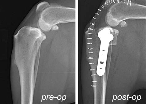 Tibial Plateau Leveling Osteotomy Tplo Surgery San Diego Encinitas