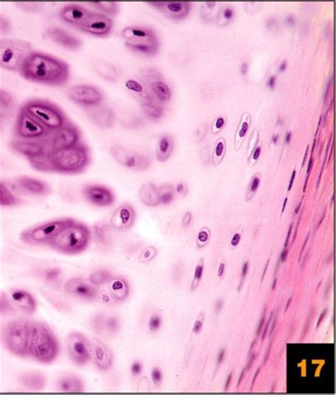 Solved Is This An Example Of Hyaline Cartilage Connective Chegg