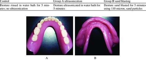 Treatment Of Denture Fitting Surfaces Download Table