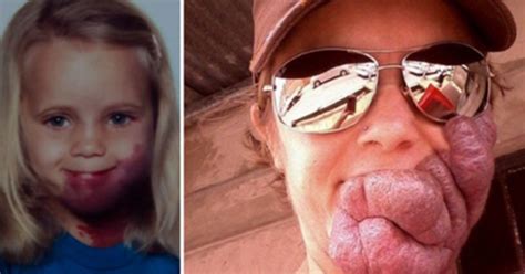 Woman With Face Deformity Gets Back At Her Bullies In The Best Possible Way Page Of