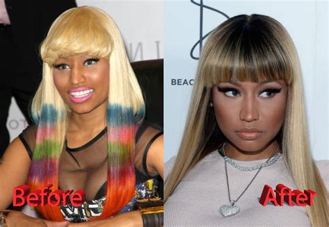 Nicki Minaj Before Plastic Surgery There Are A Lot Of Nicki Minaj