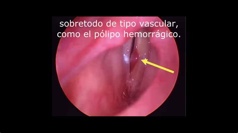 Simple Science: How to Make a Volcano with Kids