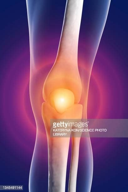 Knee Cap Photos And Premium High Res Pictures Getty Images