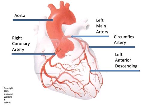 The arteries in your legs and feet can get blocked, just like the arteries in your heart. Coronary Angiography - Heartwest