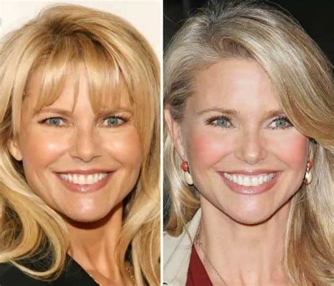 Christie Brinkley Before And After Plastic Surgery 07 Celebrity