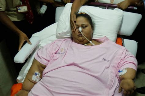 world s heaviest woman in critical condition after weight loss surgery daily star