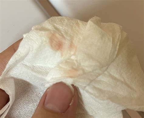 What Does Implantation Bleeding Look Like On Toilet Paper