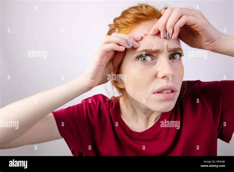 Redhead Woman Squeezing Her Pimples Removing Pimple From Her Face