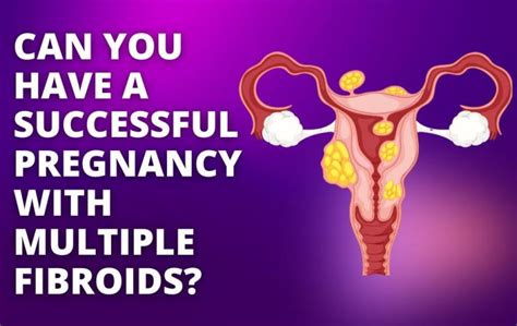 Can You Have A Successful Pregnancy With Multiple Fibroids