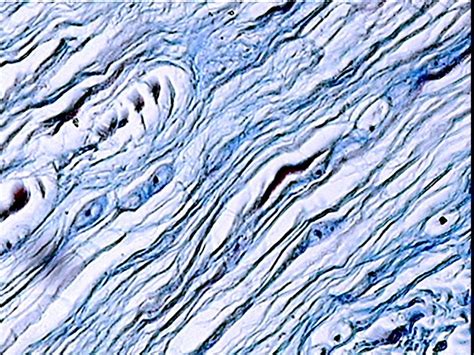 Bio 240 Human Anatomy Tissues Epithelium And Cartilage