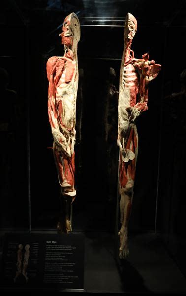 Body Worlds Rx Opens At Imagination Station The Blade