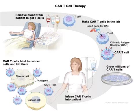 Revolutionizing Cancer Treatment Explaining Car T Cell Therapy