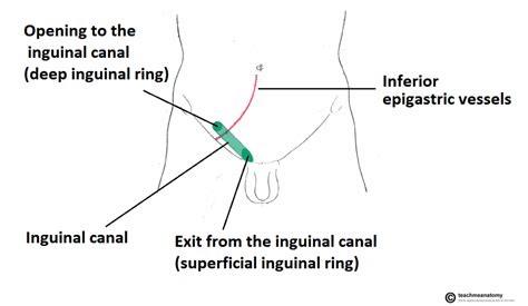 There is one inguinal canal on each side of the midline. learnmore: Hernia
