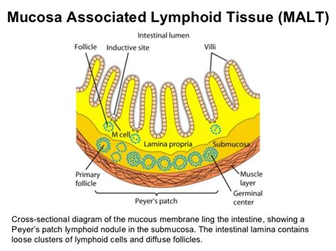 Mucosa Associated Lymphoid Tissue Mucosa Associated Lymphoid Tissue
