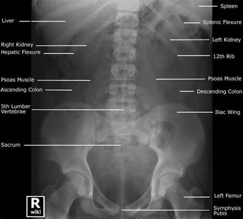 Abdomen Radiographic Anatomy Diagram Quizlet