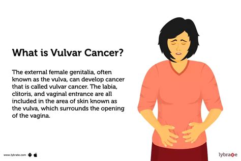 Vulvar Cancer Treatment Procedure Cost Recovery Side Effects And More