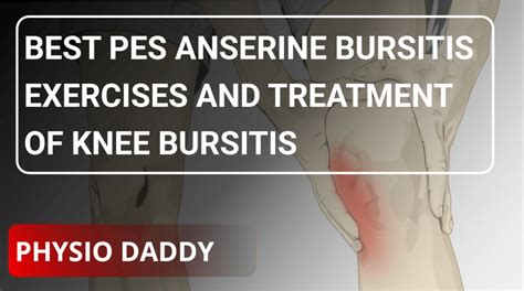 Best Pes Anserine Bursitis Exercises And Treatment Of Knee Bursitis