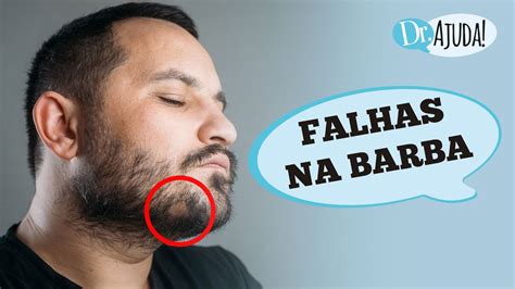 Como Evitar Falhas Na Barba E Estimular O Crescimento Saudável