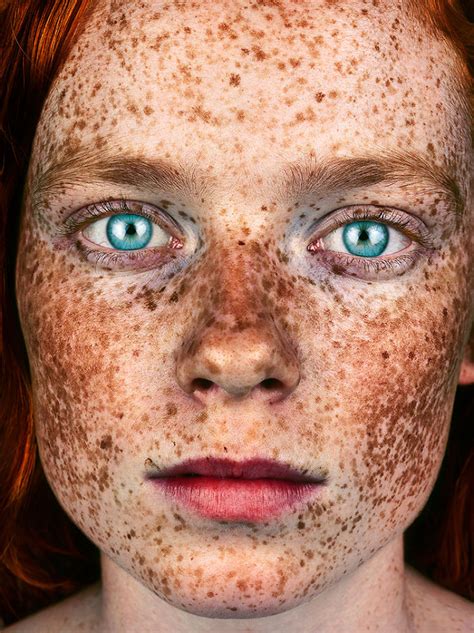 The Beauty Of The Freckles By The Photographer Brock Elbank 5a829b9e1c7d9700