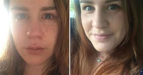 Powerful Mental Health Selfies Go Viral After Newspaper Article Claimed People Fake Mental