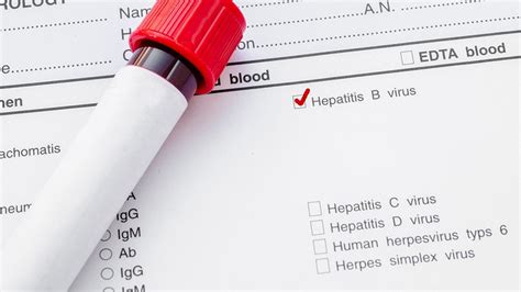 Hepatitis c is a liver infection caused by the hepatitis c virus (hcv).hepatitis c is spread through contact with blood from an infected person. Viral hepatitis kills as many as malaria, TB or HIV/AIDS ...