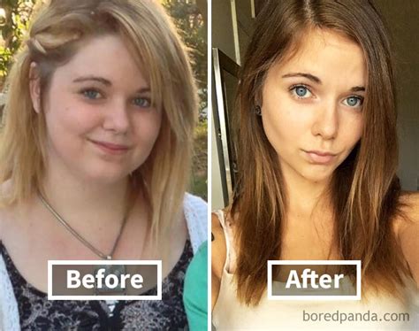 Increíbles Fotos De Antes Y Después Revelan Cómo La Pérdida De Peso