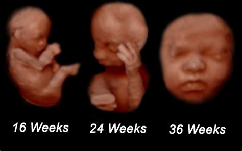 when is the best time to get a 3d ultrasound mother nurture ultrasound