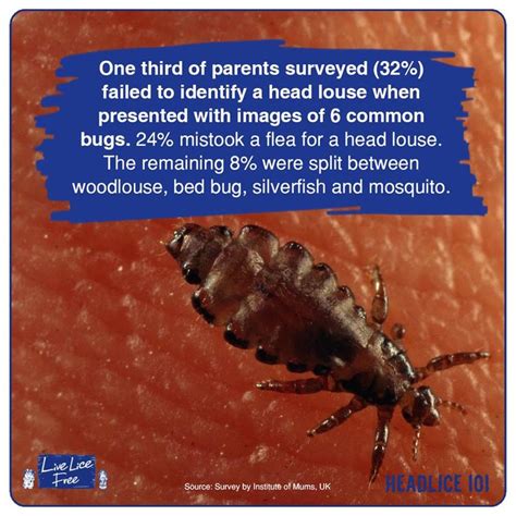 Pin By Live Lice Free On Head Lice Facts Head Louse