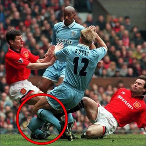 Most Amazing Pics Worst Soccer Injuries Photos Soccer Funny Injuries