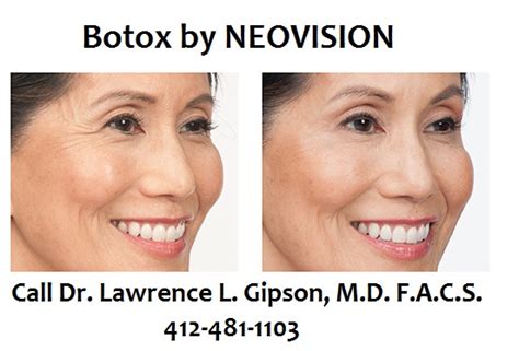 Cosmetic Procedures Pittsburgh Botox Charleroi Juvederm Pittsburgh