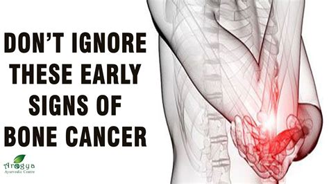 Don T Ignore These Early Signs Of Bone Cancer Symptoms Of Bone Cancer