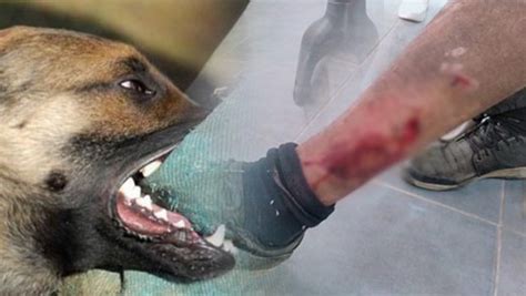 إصابة عشريني في الناظور بجروح خطيرة إثر تعرضه لهجوم شرس من طرف كلاب ضالة