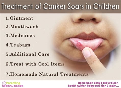 Cause And Treatment Of Canker Sores In Children