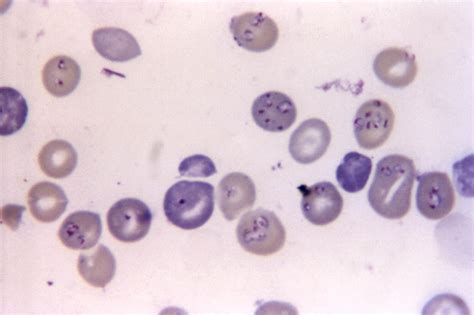 Gratis Bilde Babesiosis Forvirret Malaria Hemo Protozoan