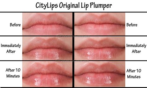 Valentine Kisses Citylips Original Lip Plumper Before And After