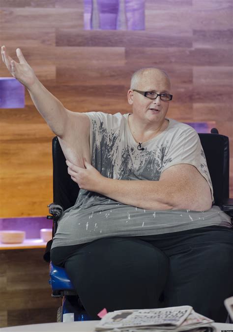 World S Fattest Man Loses 46 Stone And Needs Surgery To Remove Loose Skin Photo Huffpost Uk